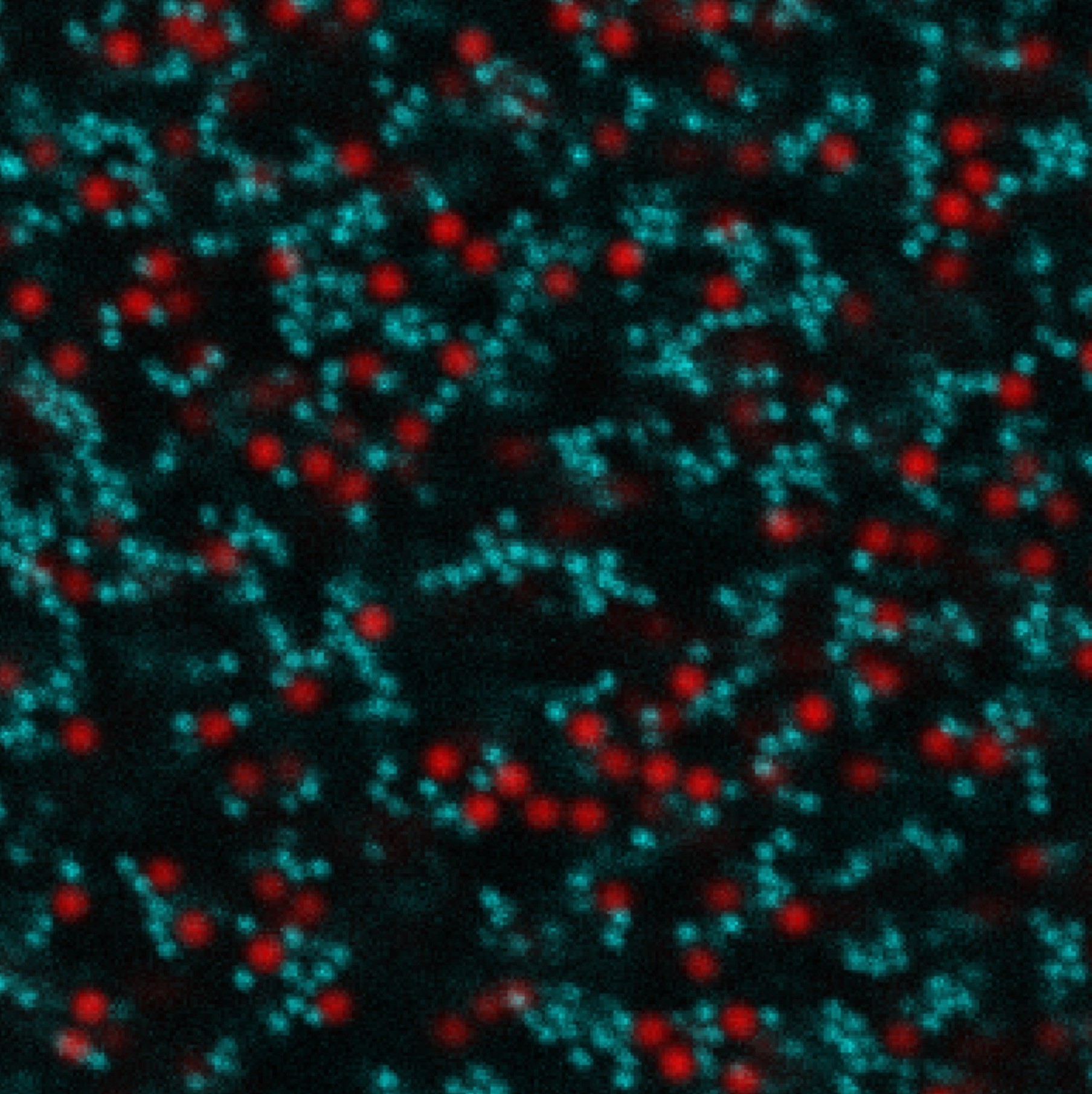 Bimodal Colloidal Gel Confocal Image